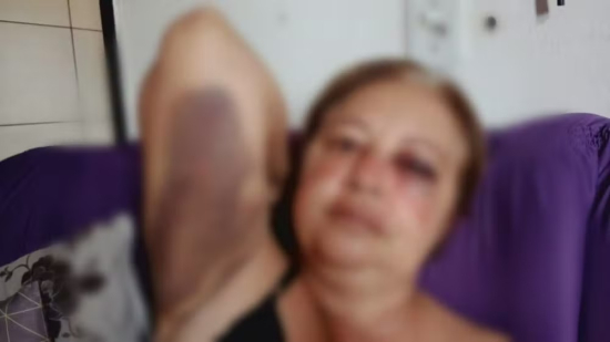 Servidora do Cras é exonerada após ser suspeita de agredir moradora em Baliza