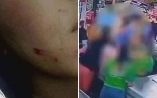 Operadora de caixa é agredida por cliente após discussão em fila de supermercado