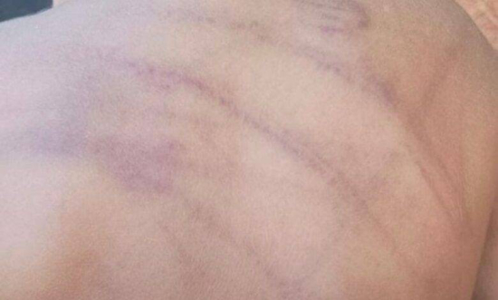 Bebê de 1 ano dá entrada em UPA com sinais de agressão em Barra do Garças