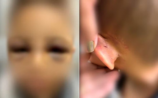 Pai é preso suspeito de espancar filho de 6 anos