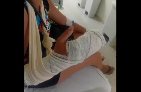 Mulher tem quatro dedos amputados após ataque de ex e caso é tratado como tentativa de feminicídio