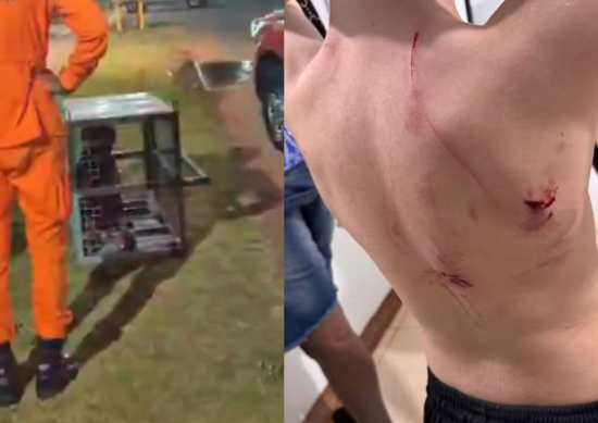 Rottweiler ataca três crianças em praças e mobiliza polícia e bombeiros