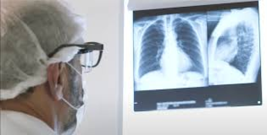 Casos graves de síndrome gripal preocupam e colocam 18 estados em alerta no Brasil