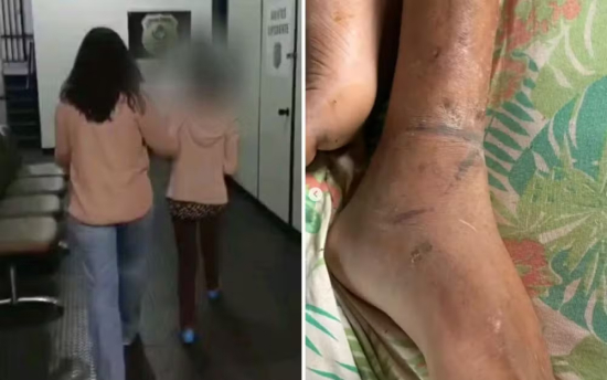 Mulher é presa por manter filho acorrentado e sem alimentação
