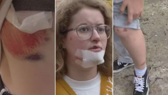 Bueiro é reestruturado após estudante cair e sofrer ferimentos