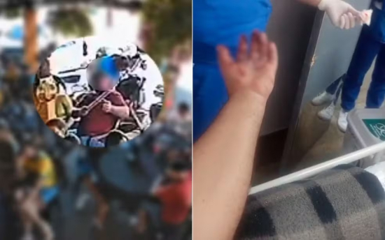 Torcedor tem mão dilacerada após explosão de rojão durante comemoração de jogo do Brasil