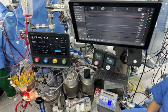 Mato Grosso estreia tecnologia inédita no Brasil em cirurgia cardíaca