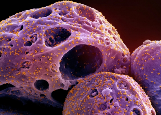 Cuiabá emite alerta e fala em 'monitoramento rigoroso' por possível aumento de casos de Covid-19