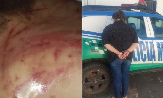 Mãe é presa suspeita de torturar filha com cipó após ela 'fazer bagunça