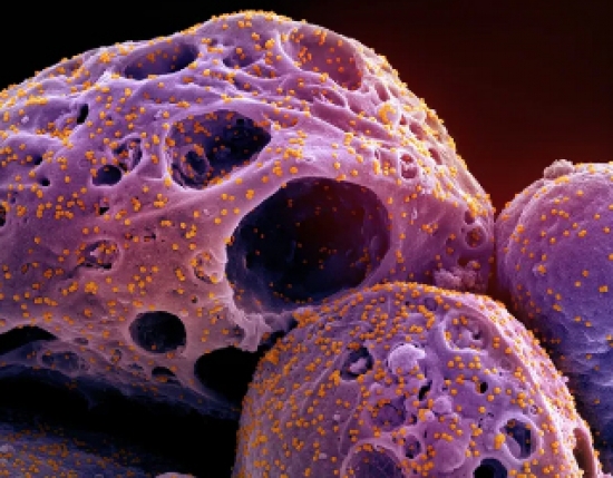 SES confirma caso de nova subvariante da Covid-19 em MT