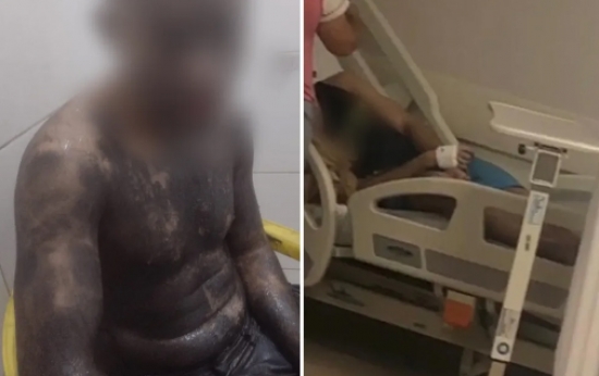 Estudante é levado a hospital após ser deixado desacordado e coberto de tinta em trote universitário, diz mãe