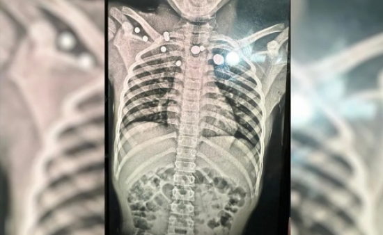 Criança é baleada ao brincar com arma do tio em comunidade Kalunga, na Chapada dos Veadeiros
