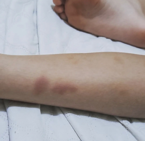 Mãe faz desabafo sobre agressões ao filho autista em escola de Barra do Garças