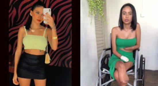 O que pode ter causado a amputação dos membros de jovem após infecção urinária