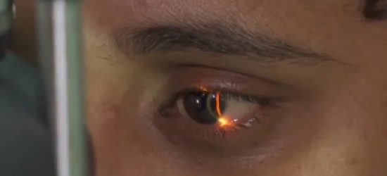 Com a umidade do ar baixa em MT, doenças como conjuntivite podem se manifestar