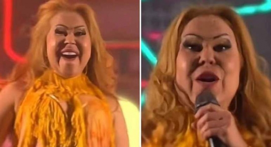 O que Joelma tem? Inchada, cantora recebe diagnóstico de doença; saiba tudo