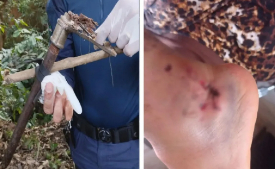 Homem é baleado por armadilha ao tentar pegar manga em árvore