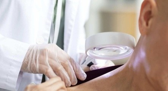 Vacina contra câncer de pele pode estar disponível em 2025, diz CEO de farmacêutica