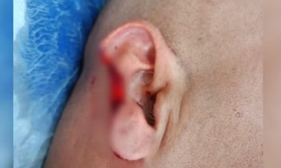 Homem arranca parte da orelha de policial durante abordagem, diz polícia