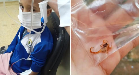 Criança é picada por escorpião enquanto estava sentada no sofá de casa