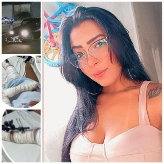 Amigos fazem PIX Solidário para ajudar garota vítima de acidente em Barra do Garças