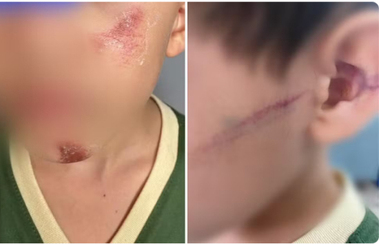 Mãe e madrasta são investigadas por bater em irmãos e esfregar rosto de um deles em parede, diz polícia