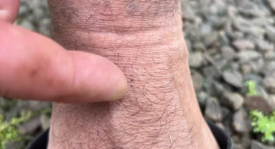 MT registra 11 casos confirmados da Febre Oropouche em menos de um mês e capital entra em alerta