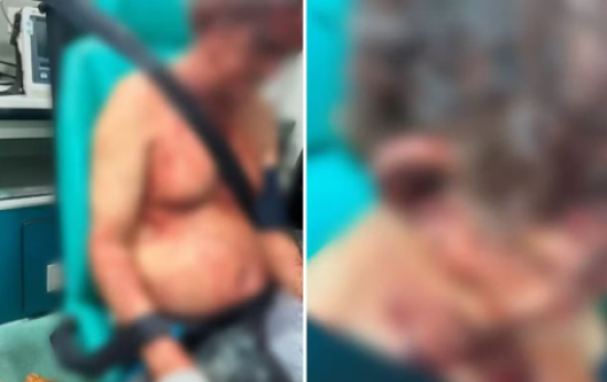 Idoso desce para ajudar mulher em rodovia, cai em emboscada e é espancado por ladrões, diz polícia