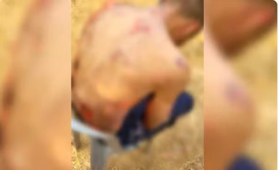 Dono de supermercado e funcionários são presos suspeitos de atear fogo e espancar com barra de ferro homem flagrado furtando sandália