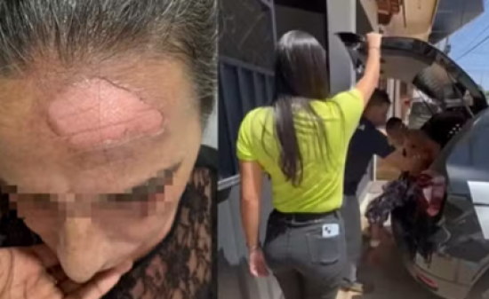 Filho joga café quente no rosto da mãe após briga por R$ 10, diz polícia