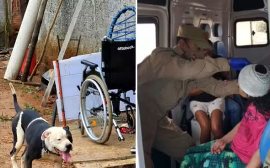 Mulher tem a orelha decepada após ser atacada por pit bull, dizem bombeiros