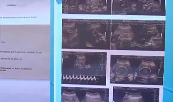 Homem com dor nas costas faz ultrassom e recebe diagnóstico de gravidez