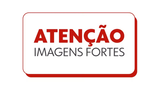 Menino de 4 anos é atacado por cachorro em condomínio em Águas Lindas de Goiás