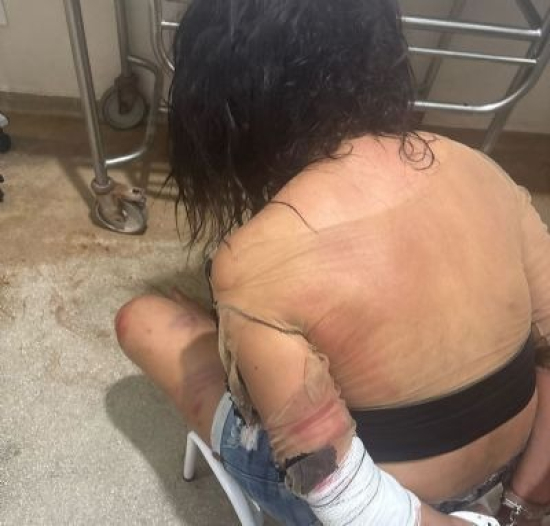 Mulher é detida após ameaçar moradores com caco de vidro