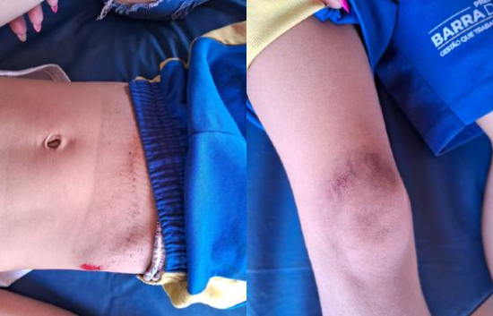 Criança de 7 anos é atropelada por motociclista em frente a escola em Barra do Garças; suspeito fugiu sem prestar socorro