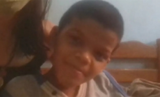 Menino de 9 anos é a primeira criança com varíola dos macacos em Goiás