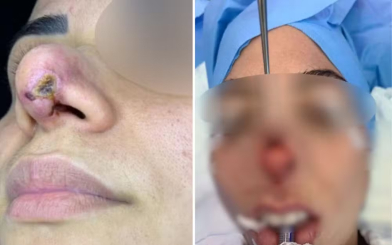 Ex-funcionário revela uso de produtos ilegais em clínica de estética de influenciadores