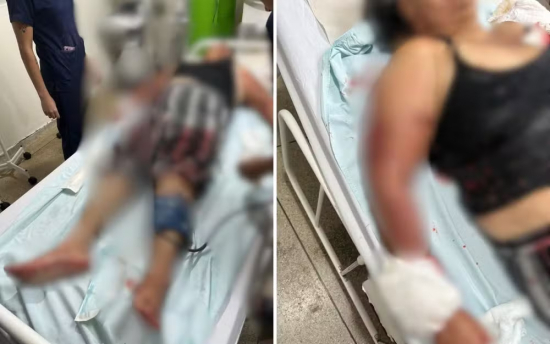 Avó salva neta de ataque de pit bull e leva mais de 60 pontos pelo corpo em Goiás