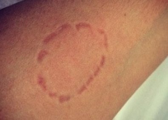 Mulher ataca marido com mordidas durante discussão em Barra do Garças