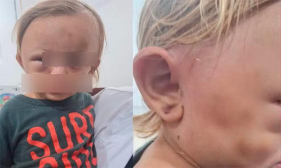 Padrasto é preso suspeito de espancar criança de 1 ano em MT; mãe adolescente é apreendida