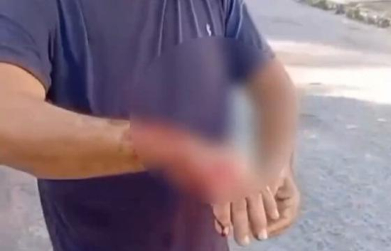 Homem é ferido ao tentar salvar cadela de ataque de pitbull em Barra do Garças; animal não resistiu