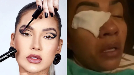 Mulher afirma ter ficado cega após usar produto da marca de Virginia Fonseca; família prepara ação judicial