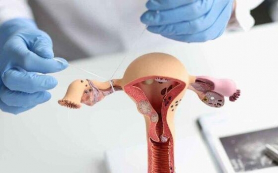 Sancionada lei que dispensa aval do parceiro para realização de laqueadura e vasectomia