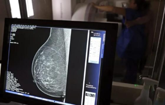 Ministério da Saúde recebe medicamento inédito para tratamento de câncer de mama no SUS